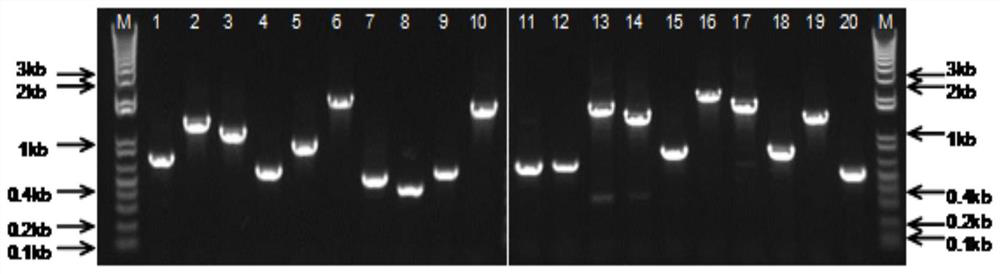 一種棘阿米巴特異性抗原肽、多克隆抗體及其用途